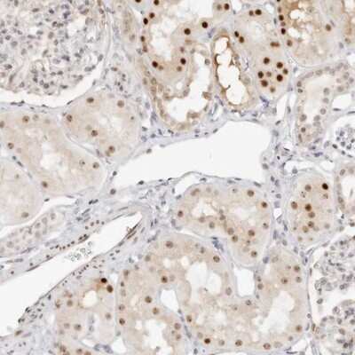 Immunohistochemistry-Paraffin: HIPK3 Antibody [NBP1-84950] - Staining of human kidney shows strong nuclear positivity in cells in tubules.
