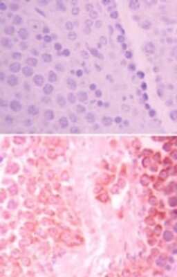 Immunohistochemistry-Paraffin: HIPK3 Antibody [NBP2-24521] - Analysis of HIPK3 in formalin-fixed, paraffin-embedded mouse testis tissue using an isotype control (top) and this antibody (bottom) at 5 ug/ml.