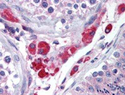 Immunohistochemistry-Paraffin: HIPK3 Antibody [NBP2-24521] - Analysis of human testis using this antibody at 10 ug/ml.