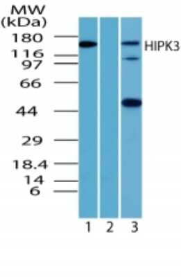 Western Blot: HIPK3 Antibody [NBP2-24521] - Analysis of HIPK3 in mouse testis lysate in the 1) absence, 2) presence of immunizing peptide and 3) rat testis using this antibody at 1 ug/ml. Goat anti-rabbit Ig HRP secondary antibody and PicoTect ECL substrate solution were used for this test.