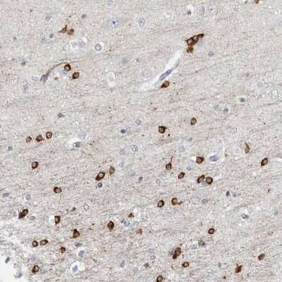 Immunohistochemistry-Paraffin: HIPK4 Antibody [NBP1-81987] - Staining of human cerebral cortex shows strong cytoplasmic positivity in a subset of glial cells.