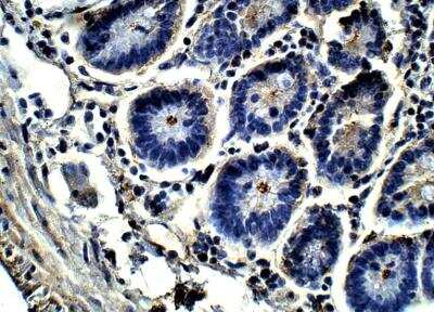 Immunohistochemistry-Paraffin: HIPK4 Antibody [NBP3-12399] - Rat small intestine. 1:50 dilution in IHC blocking buffer. DAB (brown) staining in Hematoxlyin QS (blue) counerstain. 40x magnification.