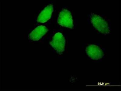 Immunocytochemistry/Immunofluorescence: HIRA Antibody [H00007290-B01P] - Analysis of purified antibody to HIRA on HeLa cell. (antibody concentration 10 ug/ml)