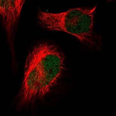 Immunocytochemistry/Immunofluorescence: HIRA Antibody [NBP2-55647] - Staining of human cell line HeLa shows localization to nucleoplasm.