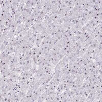 Immunohistochemistry-Paraffin: HIRA Antibody [NBP2-38636] - Staining of human liver shows low expression as expected.