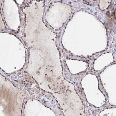 Immunohistochemistry-Paraffin: HIRA Antibody [NBP2-38636] - Staining of human thyroid gland shows high expression.