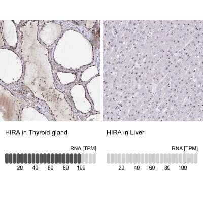 <b>Orthogonal Strategies Validation. </b>Immunohistochemistry-Paraffin: HIRA Antibody [NBP2-38636] - Staining in human thyroid gland and liver tissues using anti-HIRA antibody. Corresponding HIRA RNA-seq data are presented for the same tissues.