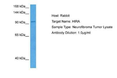 Western Blot: HIRA Antibody [NBP2-87391] - Host: Rabbit. Target Name: HIRA. Sample Tissue: Human Neurofibroma Tumor lysates. Antibody Dilution: 1ug/ml