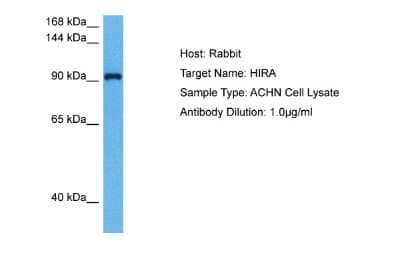 Western Blot: HIRA Antibody [NBP2-87569] - Host: Rabbit. Target Name: HIRA. Sample Tissue: Human ACHN Whole Cell lysates. Antibody Dilution: 1ug/ml