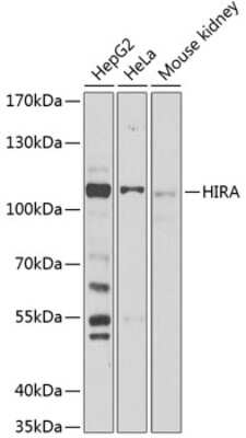 Western Blot: HIRA Antibody [NBP3-04893] - Analysis of extracts of various cell lines, using HIRA antibody at 1:1000 dilution. Secondary antibody: HRP Goat Anti-Rabbit IgG (H+L) at 1:10000 dilution. Lysates/proteins: 25ug per lane. Blocking buffer: 3% nonfat dry milk in TBST. Detection: ECL Basic