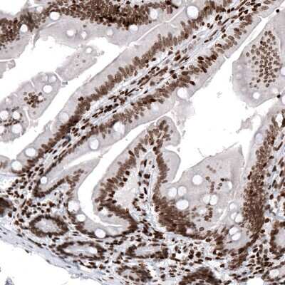 Immunohistochemistry: HIST1H2AG Antibody (CL5041) [NBP2-61152] - Staining of human duodenum shows strong nuclear immunoreactivity in glandular cells and in cells in lamina propria.