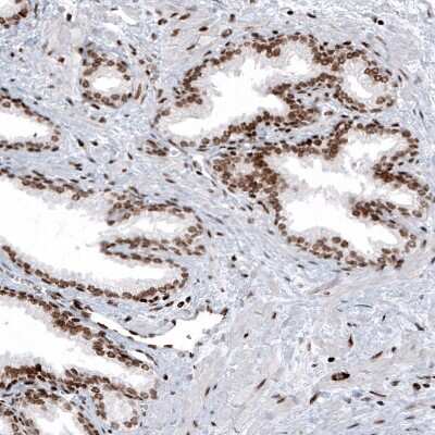 Immunohistochemistry: HIST1H2AG Antibody (CL5041) [NBP2-61152] - Staining of human prostate shows strong nuclear positivity in glandular and smooth muscle cells.