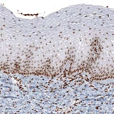 Immunohistochemistry: HIST1H2AG Antibody (CL5041) [NBP2-61152] - Staining of human cervix shows moderate to strong nuclear positivity in epithelial and connective tissue cells.