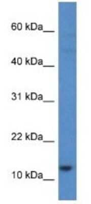 Western Blot: HIST1H2AH Antibody [NBP1-79874] - HT1080 Cell Lysate 1ug/ml  Gel Concentration 10-20%