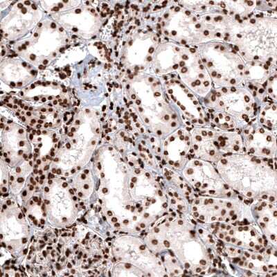 Immunohistochemistry: HIST1H2BC Antibody (CL5048) [NBP2-61153] - Staining of human kidney shows strong nuclear positivity in renal tubules and in glomerular cells.