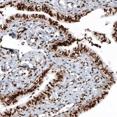 Immunohistochemistry: HIST1H2BC Antibody (CL5101) [NBP2-61154] - Staining of human fallopian tube shows strong nuclear immunoreactivity in glandular and stromal cells.