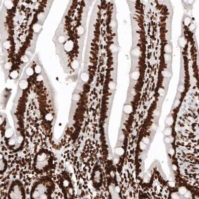 Immunohistochemistry: HIST1H2BC Antibody (CL5101) [NBP2-61154] - Staining of human duodenum shows strong nuclear immunoreactivity in glandular cells and in lamina propria cells.