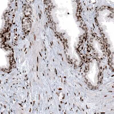 Immunohistochemistry: HIST1H2BC Antibody (CL5101) [NBP2-61154] - Staining of human prostate shows moderate to strong nuclear positivity in glandular and smooth muscle cells.