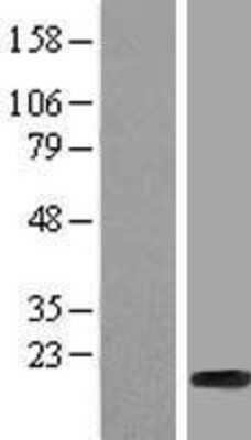 Western Blot HIST1H2BF Overexpression Lysate