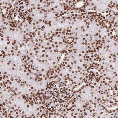 Immunohistochemistry HIST1H2BD Antibody