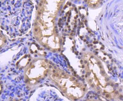 Immunohistochemistry-Paraffin: HIST1H2BK [ac Lys20] Antibody (SN72-09) [NBP2-67682] - Analysis of paraffin-embedded human kidney tissue using anti-Histone H2B(acetyl K20) antibody. Counter stained with hematoxylin.