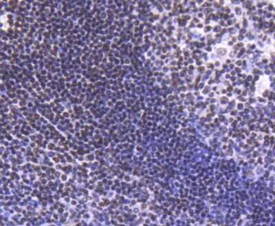 Immunohistochemistry-Paraffin: HIST1H2BK [ac Lys20] Antibody (SN72-09) [NBP2-67682] - Analysis of paraffin-embedded human tonsil tissue using anti-Histone H2B(acetyl K20) antibody. Counter stained with hematoxylin.