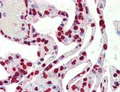Immunohistochemistry: Histone H3 Antibody [NBP2-44215] - Analysis of Tissue: Lung Fixation: formalin fixed paraffin embedded Antigen retrieval: user optimized Primary antibody: Histone H3 antibody 1:100 Secondary antibody: Peroxidase goat anti-rabbit at 1:10,000 for 45 min at RT.