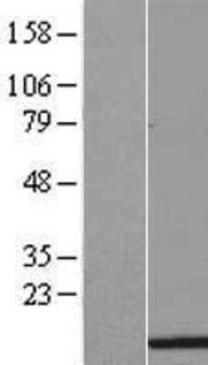 Western Blot HIST1H3H Overexpression Lysate