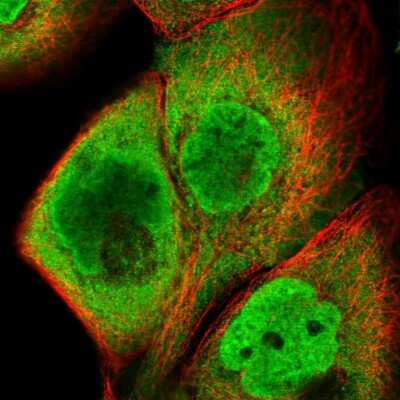 Immunocytochemistry/Immunofluorescence: HIST3H2BB Antibody [NBP2-31878] - Immunofluorescent staining of human cell line A-431 shows localization to nucleoplasm & cytosol.