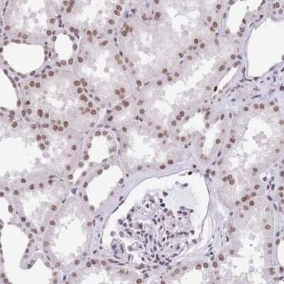 Immunohistochemistry: HIST3H2BB Antibody [NBP2-31878] - Staining of human kidney shows moderate nuclear positivity in cells in tubules.