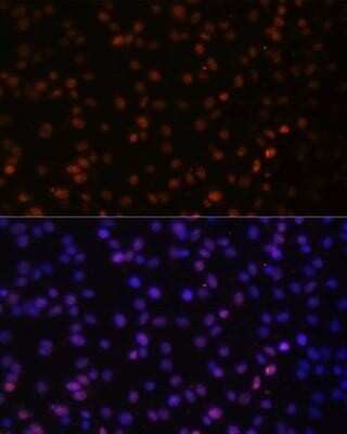 Immunocytochemistry/Immunofluorescence: HIV-1 Tat specific factor 1 Antibody [NBP3-03306] - Analysis of C6 cells using HIV-1 Tat specific factor 1 antibody at dilution of 1:100. Blue: DAPI for nuclear staining.