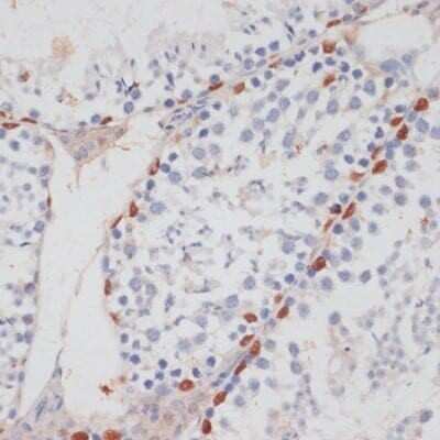 Immunohistochemistry-Paraffin: HIV-1 Tat specific factor 1 Antibody [NBP3-03306] - Paraffin-embedded mouse testis using HIV-1 Tat specific factor 1 antibody at dilution of 1:100 (40x lens).