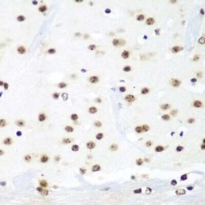 Immunohistochemistry-Paraffin HIV-1 Tat specific factor 1 Antibody - BSA Free