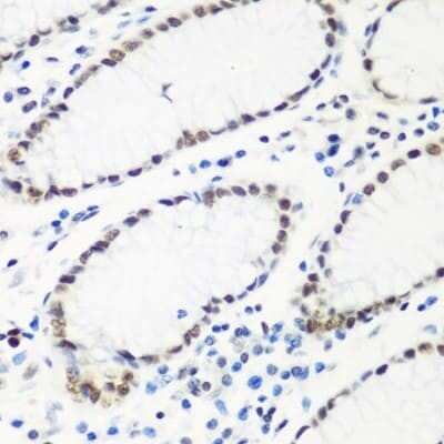 Immunohistochemistry-Paraffin HIV-1 Tat specific factor 1 Antibody - BSA Free