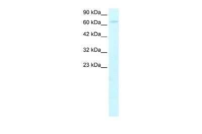 Western Blot: HIV-1 Tat specific factor 1 Antibody [NBP2-87571] - WB Suggested Anti-HTATSF1 Antibody Titration: 0.2-1 ug/ml. ELISA Titer: 1:62500. Positive Control: HepG2 cell lysate