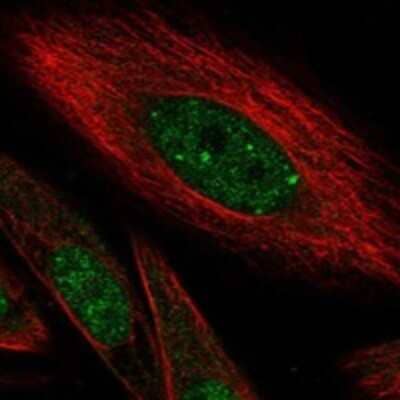 Immunocytochemistry/Immunofluorescence: HIVEP1 Antibody [NBP3-17504] - Staining of human cell line SiHa shows localization to nucleoplasm & nuclear bodies.