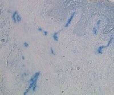 Immunohistochemistry: HKCR Antibody (117E10.10) [DDX0351P-100] - Staining of human skin frozen section.