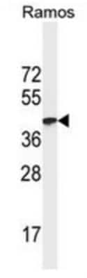 Western Blot: HLA A Antibody (7G7F9) [NBP2-41429] - Analysis of HLA-A Antibody in Ramos cell line lysates (35 ug/lane). HLA-A (arrow) was detected using the purified MAb (1:500)