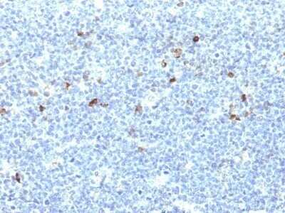 Immunohistochemistry-Paraffin: HLA A Antibody (CATA-1) - Azide and BSA Free [NBP2-47673] - Human Tonsil stained with MHC I Monoclonal Antibody (CATA-1).