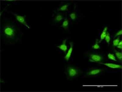 Immunocytochemistry/Immunofluorescence: HLA A Antibody [H00003105-D01P] - Analysis of antibody to HLA-A on HeLa cell. Antibody concentration 30 ug/ml.