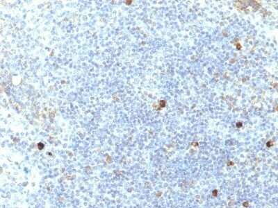 Immunohistochemistry-Paraffin: HLA A Antibody (SPM417) - IHC-Prediluted [NBP2-48098] - Human Tonsil stained with MHC I Monoclonal Antibody (SPM417).