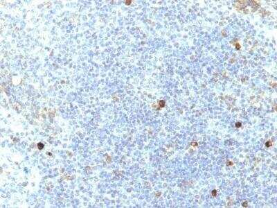 Immunohistochemistry-Paraffin: HLA A Antibody (SPM417) [NBP3-11399] - Human Tonsil stained with HLA A antibody.