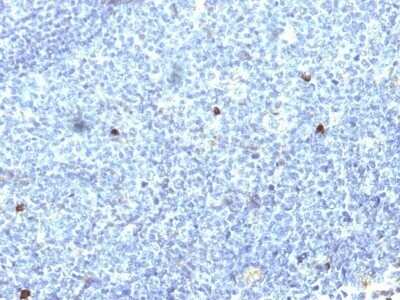 Immunohistochemistry-Paraffin: HLA A Antibody (SPM418) - IHC-Prediluted [NBP2-48097] - Human Tonsil stained with MHC I Monoclonal Antibody (SPM418).