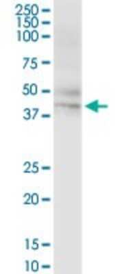 Western Blot: HLA A Antibody [H00003105-D01P] - Analysis of HLA-A expression in human spleen.