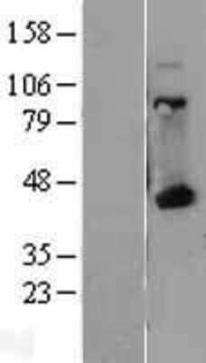 Western Blot: HLA A Overexpression Lysate (Adult Normal) [NBL1-11581] Left-Empty vector transfected control cell lysate (HEK293 cell lysate); Right -Over-expression Lysate for HLA A.