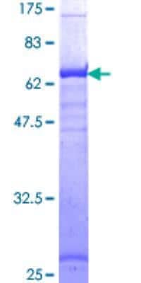SDS-Page: HLA A Recombinant Protein [H00003105-P01] - 12.5% SDS-PAGE Stained with Coomassie Blue.