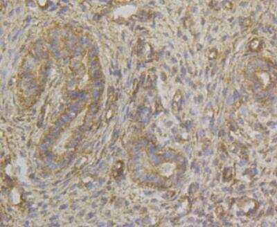 Immunohistochemistry: HLA B Antibody (11C2) [NBP2-76879] - Immunohistochemical analysis of paraffin-embedded rat uterus tissue using anti-HLA Class 1 ABC antibody. The section was pre-treated using heat mediated antigen retrieval with Tris-EDTA buffer (pH 8.0-8.4) for 20 minutes.The tissues were blocked in 5% BSA for 30 minutes at room temperature, washed with ddH2O and PBS, and then probed with the antibody at 1/200 dilution, for 30 minutes at room temperature and detected using an HRP conjugated compact polymer system. DAB was used as the chrogen. Counter stained with hematoxylin and mounted with DPX.