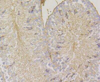 Immunohistochemistry: HLA B Antibody (11C2) [NBP2-76879] - Immunohistochemical analysis of paraffin-embedded mouse testis tissue using anti-HLA Class 1 ABC antibody. The section was pre-treated using heat mediated antigen retrieval with Tris-EDTA buffer (pH 8.0-8.4) for 20 minutes.The tissues were blocked in 5% BSA for 30 minutes at room temperature, washed with ddH2O and PBS, and then probed with the antibody at 1/200 dilution, for 30 minutes at room temperature and detected using an HRP conjugated compact polymer system. DAB was used as the chrogen. Counter stained with hematoxylin and mounted with DPX.