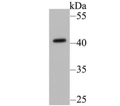 Western Blot: HLA B Antibody (11C2) [NBP2-76879] - Western blot analysis of HLA Class 1 ABC on Hela cell lysate. Proteins were transferred to a PVDF membrane and blocked with 5% BSA in PBS for 1 hour at room temperature. The primary antibody was used at a 1:2,000 dilution in 5% BSA at room temperature for 2 hours. Goat Anti-Mouse IgG - HRP Secondary Antibody (HA1006) at 1:5,000 dilution was used for 1 hour at room temperature.