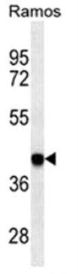 Western Blot: HLA B Antibody (7G7F9) [NBP2-41437] - HLA-B Antibody western blot analysis in Ramos cell line lysates (35 ug/lane).This demonstrates the HLA-B antibody detected the HLA-B protein (arrow).